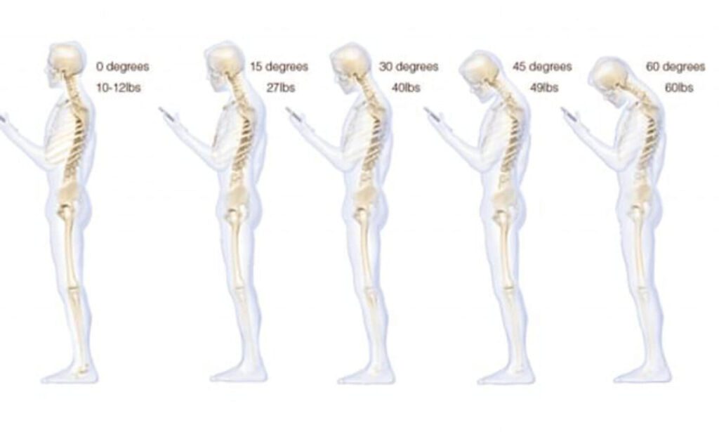 Posture while looking at phone
